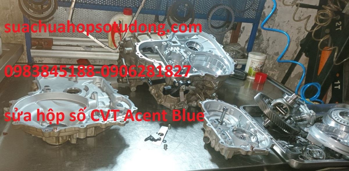 SỬA HỘP SỐ CVT ACENT BLUE